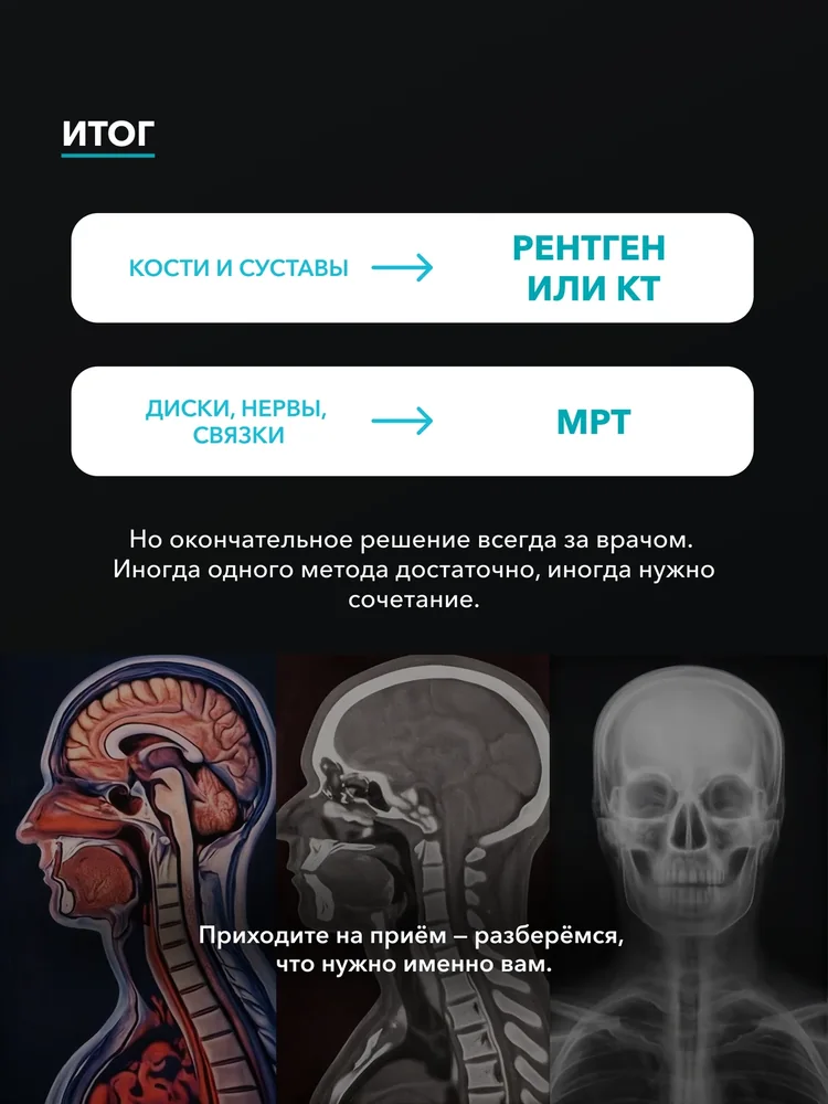 КТ, МРТ, рентген: в чём разница — 6
