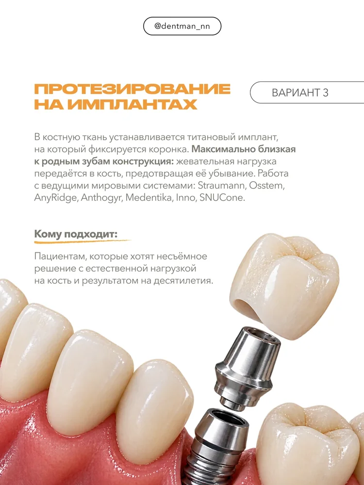 Когда отсутствует много зубов — 4