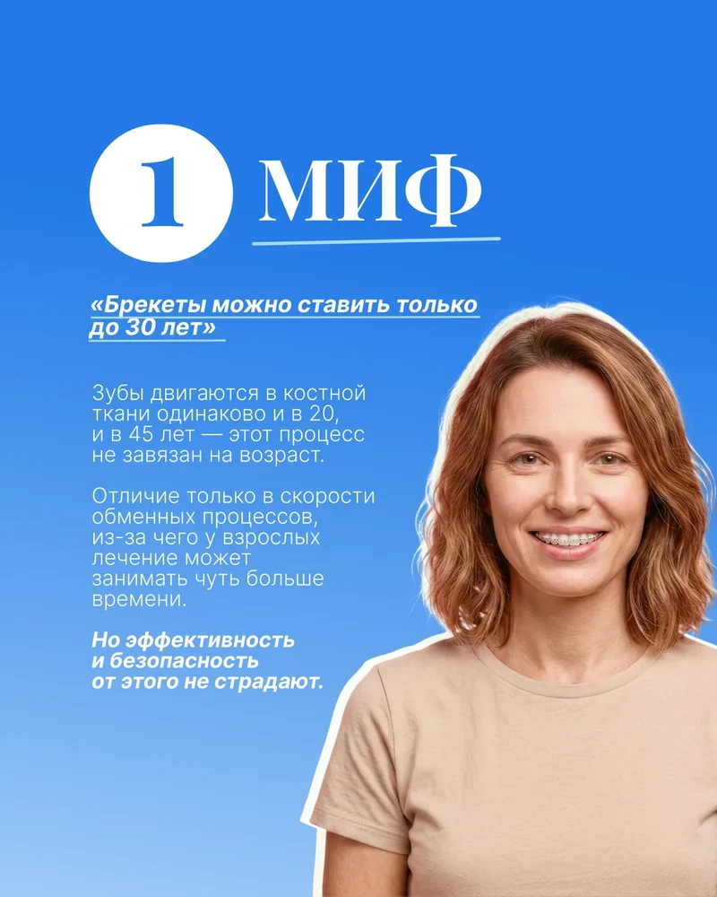 5 мифов о брекетах — 2