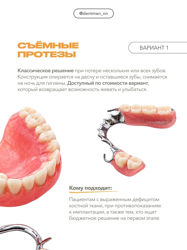 Когда отсутствует много зубов — 2