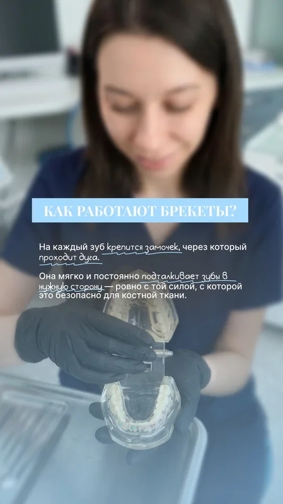 Ортодонтия: брекеты — 4