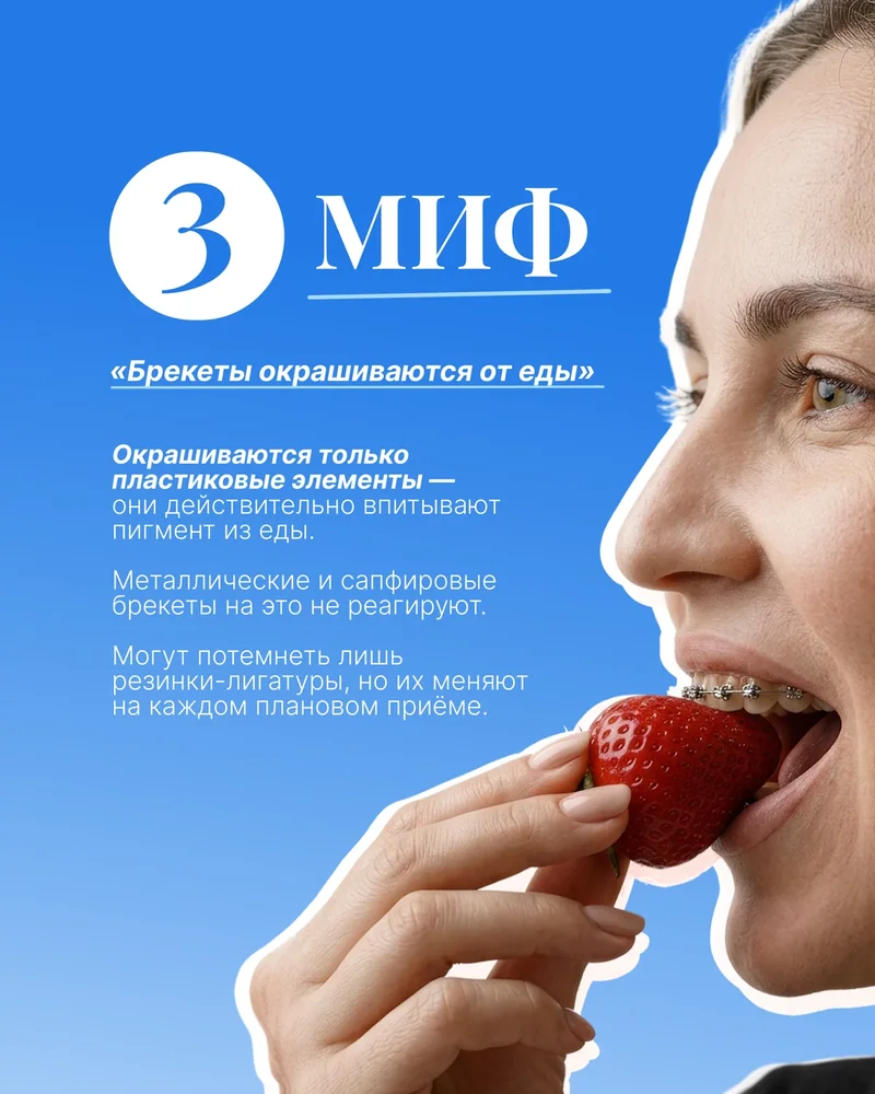 5 мифов о брекетах — 4