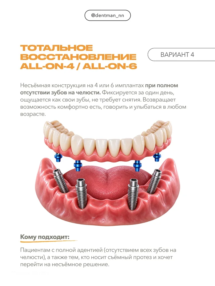 Когда отсутствует много зубов — 5