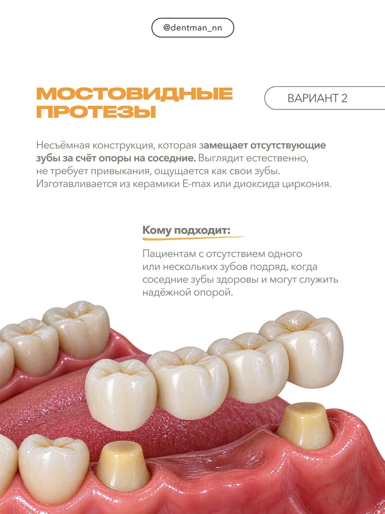 Когда отсутствует много зубов — 3