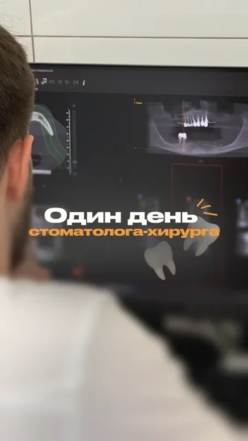 Один день стоматолога-хирурга