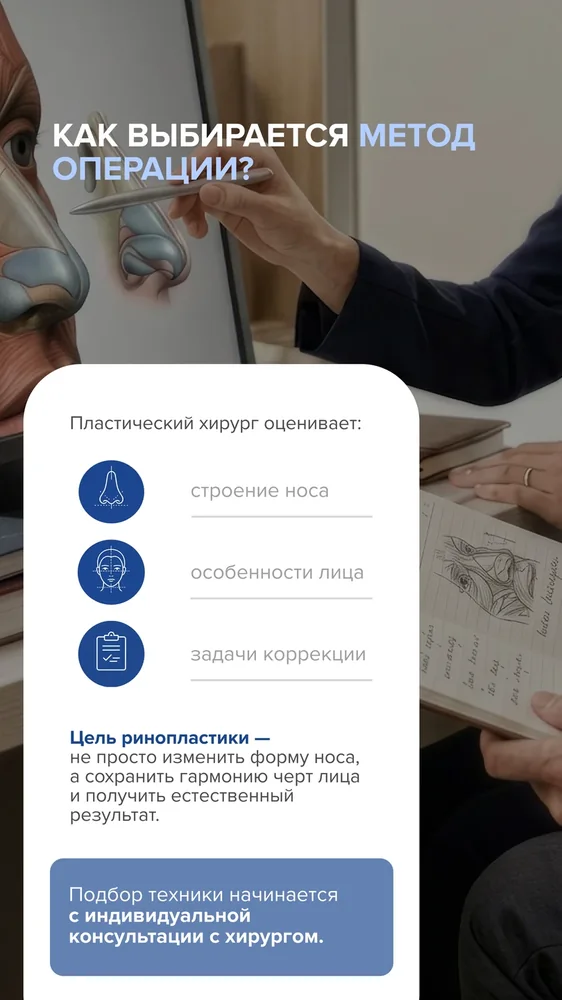 Ринопластика: открытая или закрытая — 4