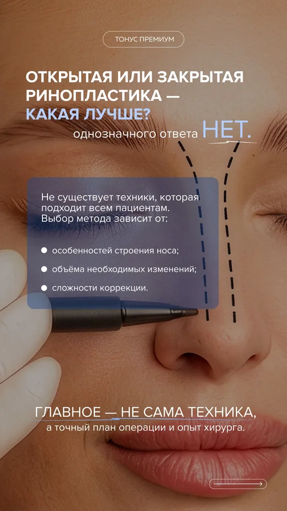 Ринопластика: открытая или закрытая — 1