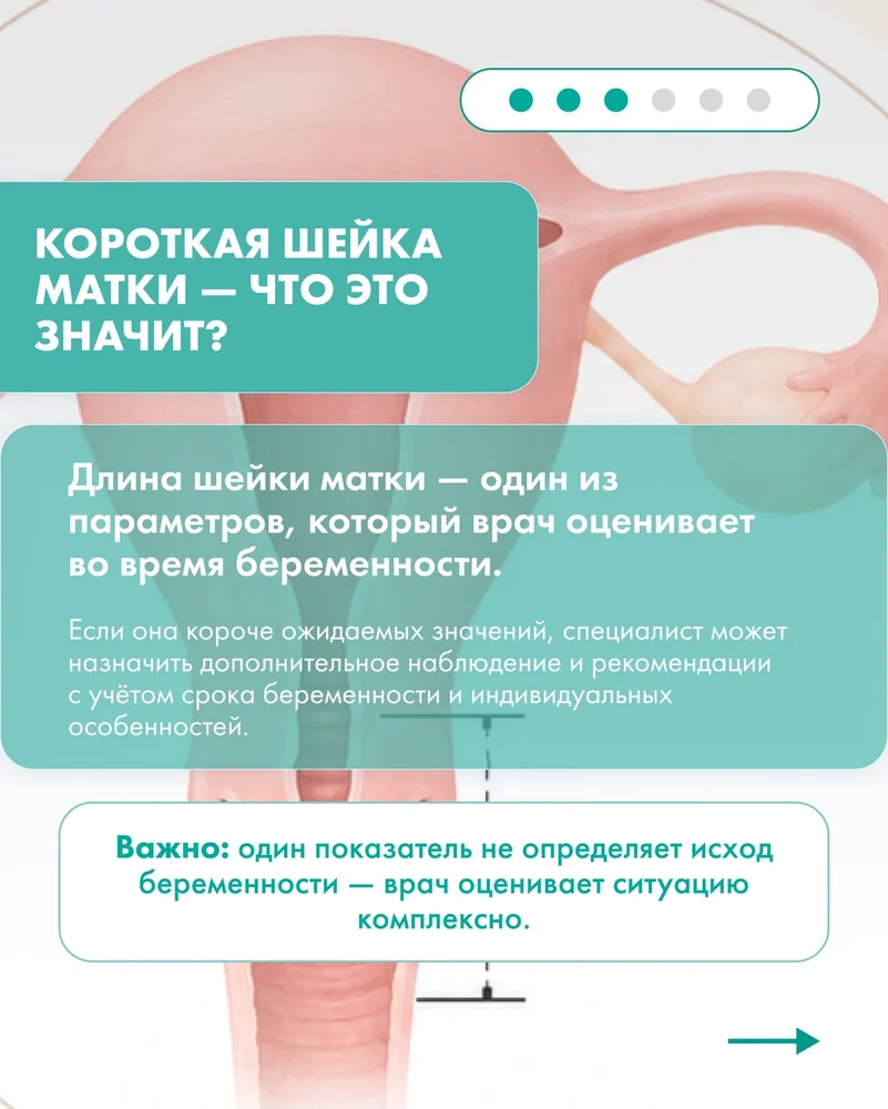 Тонус Мама: 5 вопросов о беременности — 3